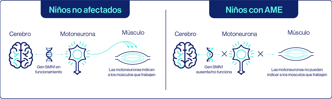 Comparación neuronal en AME y sanos Comparación neuronal en AME y sanos