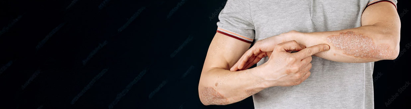 banner_reumatologia_artritis_psoriasica banner_reumatologia_artritis_psoriasica