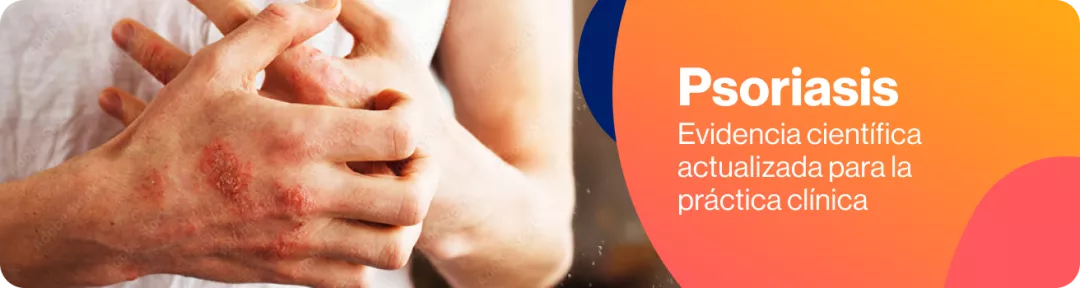 banner psoriasis