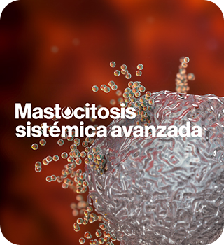 Mastocitosis-sistemica-avanzada-mobile Mastocitosis-sistemica-avanzada-mobile