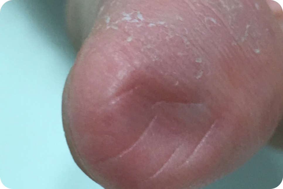 a a