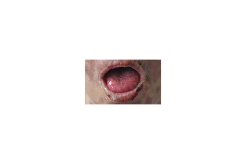 a a