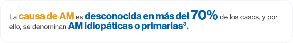 Causa del AM Causa del AM