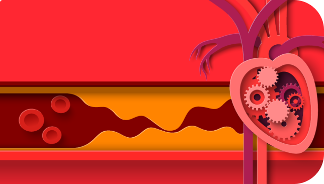 Aterosclerosis Aterosclerosis