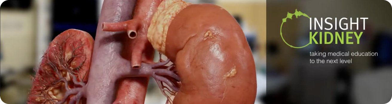 insight kidney insight kidney