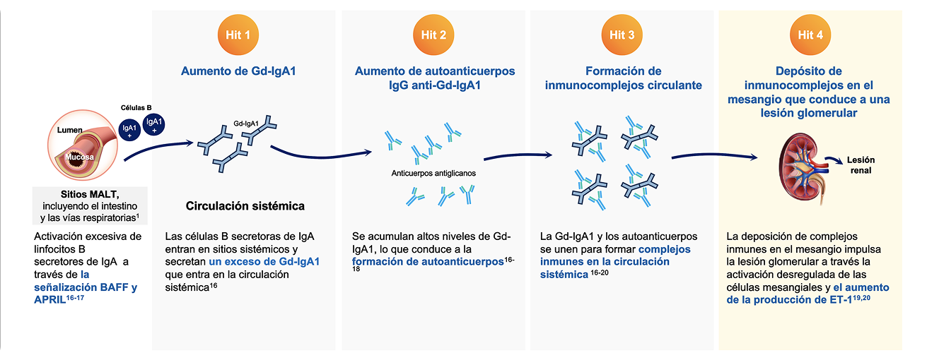 Patogénesis y Fisiopatología: teoría de los 4 Hits Patogénesis y Fisiopatología: teoría de los 4 Hits