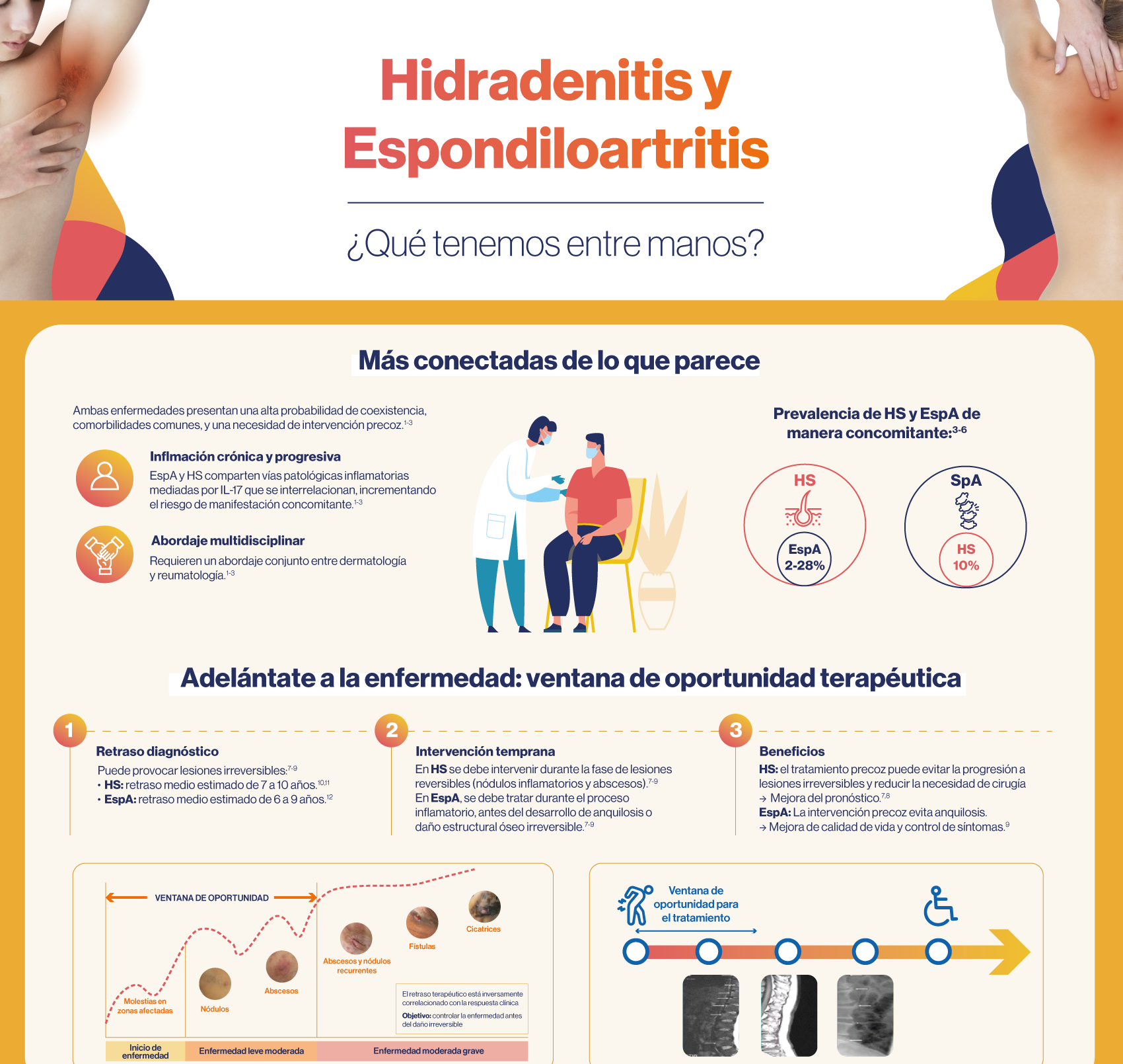 INFOGRAFÍA Hidradenitis y Espondiloartritis INFOGRAFÍA Hidradenitis y Espondiloartritis