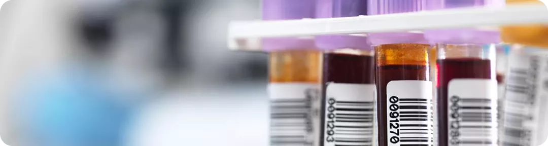 Criterios de evaluación y seguimiento de la respuesta