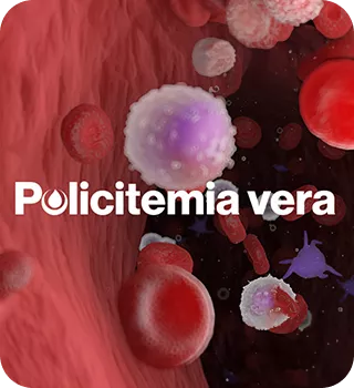 policitemia-vera-mobile