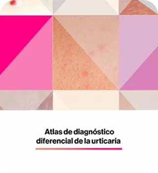 Atlas_de_la_urticaria_mobile