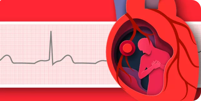 insuficiencia cardiaca
