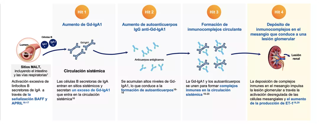 Patogénesis y Fisiopatología: teoría de los 4 Hits