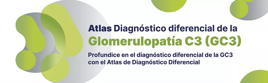 Atlas de Diagnóstico Diferencial en Glomerulopatía C3 Atlas de Diagnóstico Diferencial en Glomerulopatía C3