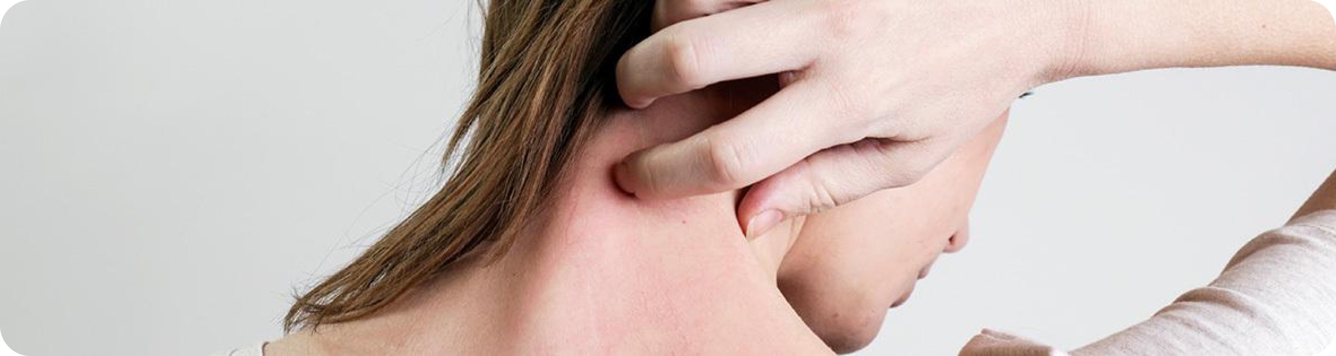 Urticaire chronique spontanée