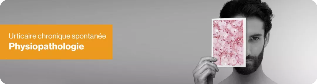 Physiopathologie de l’urticaire : de l’activation des mastocytes aux symptômes d’urticaire