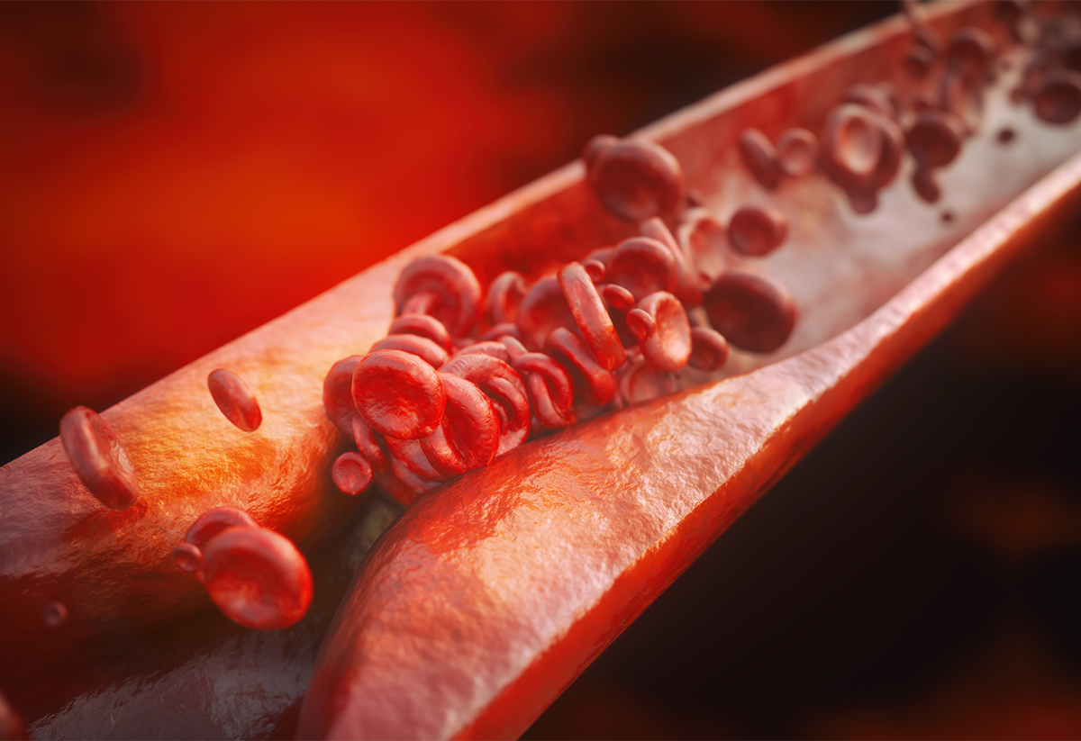 Lipido_L2_BLOCK2_1200x823.jpg Lipido_L2_BLOCK2_1200x823.jpg