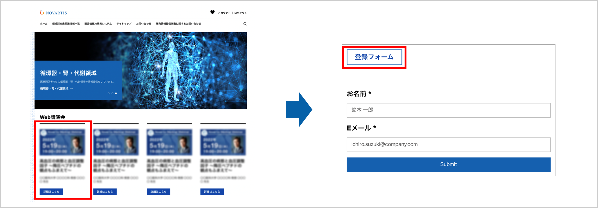 novartis_medical_webinar_02.png novartis_medical_webinar_02.png