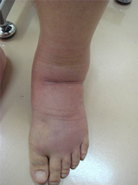 support_lecture_joint_finding_thumbnail_case001_01.png support_lecture_joint_finding_thumbnail_case001_01.png