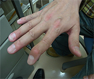 support_lecture_joint_finding_thumbnail_case002.png support_lecture_joint_finding_thumbnail_case002.png