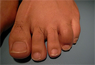 support_lecture_joint_finding_thumbnail_case003.png support_lecture_joint_finding_thumbnail_case003.png