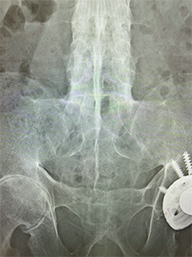support_lecture_joint_finding_thumbnail_case005.png support_lecture_joint_finding_thumbnail_case005.png