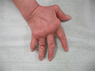 support_lecture_joint_finding_thumbnail_case006.png support_lecture_joint_finding_thumbnail_case006.png