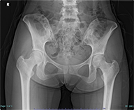 support_lecture_joint_finding_thumbnail_case008.png support_lecture_joint_finding_thumbnail_case008.png