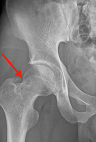 support_lecture_joint_finding_thumbnail_case009.png support_lecture_joint_finding_thumbnail_case009.png