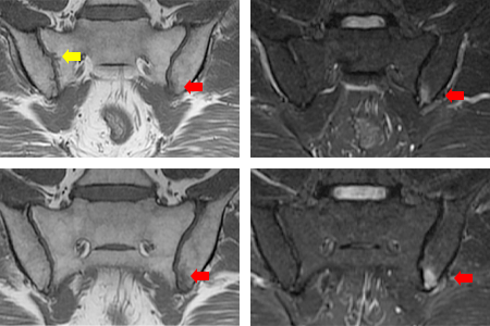 case001_answer_02_rev.png case001_answer_02_rev.png