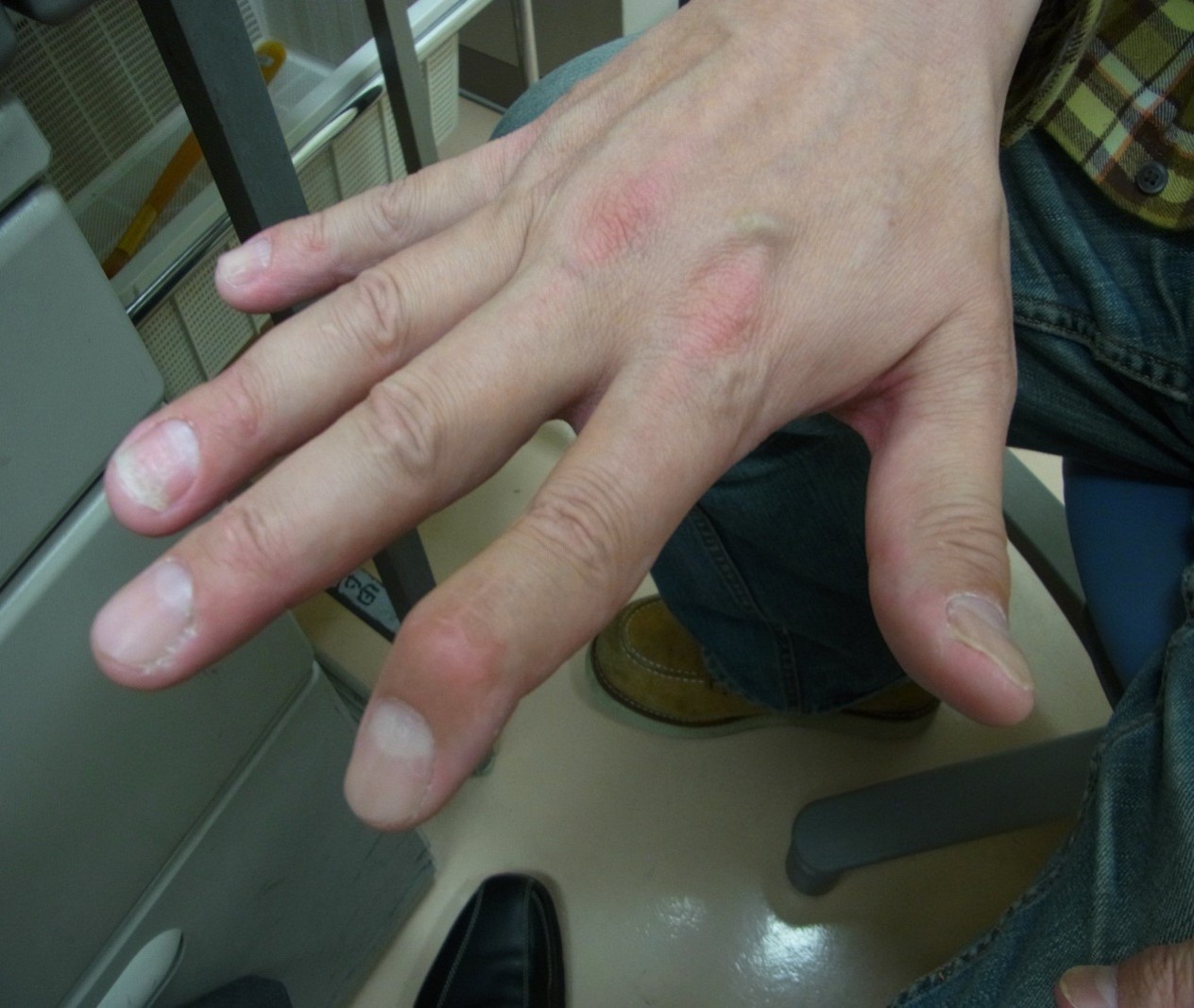 case002_01.jpg case002_01.jpg