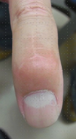 case002_02.jpg case002_02.jpg