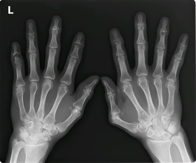 case002_answer_03.jpg case002_answer_03.jpg