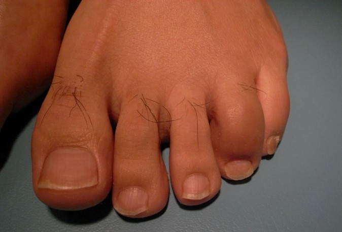 case003_02.jpg case003_02.jpg