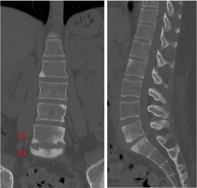 case004_01.jpg case004_01.jpg