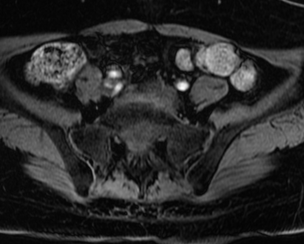 case004_answer_3.jpg case004_answer_3.jpg