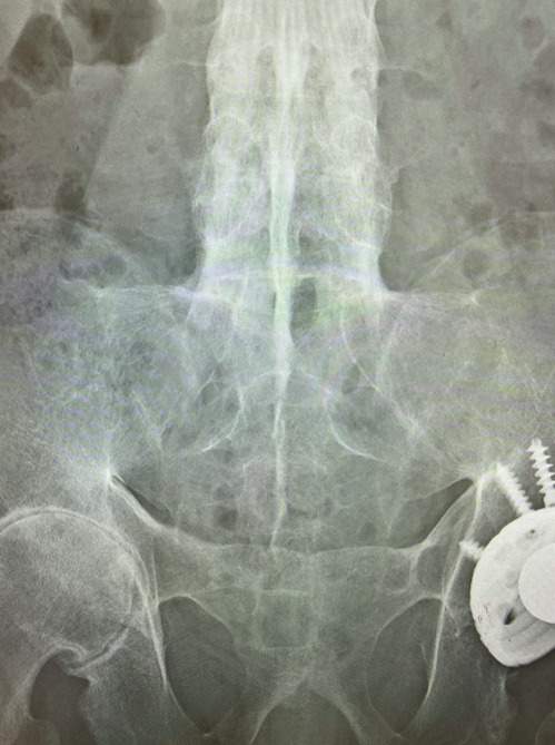 case005_01.png case005_01.png
