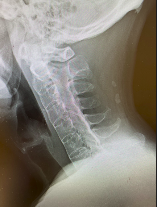 case005_02.png case005_02.png