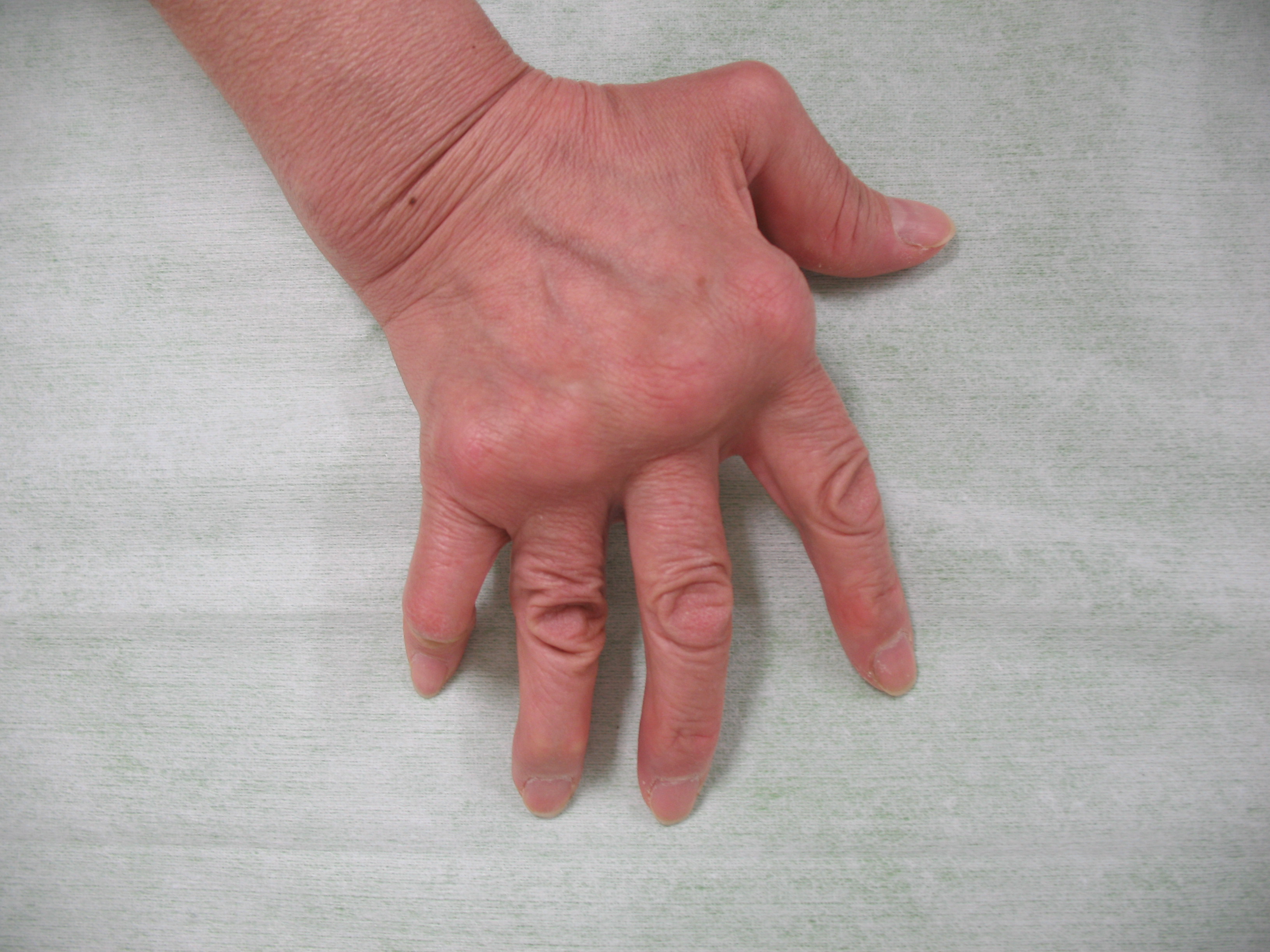 case006_01.jpg case006_01.jpg