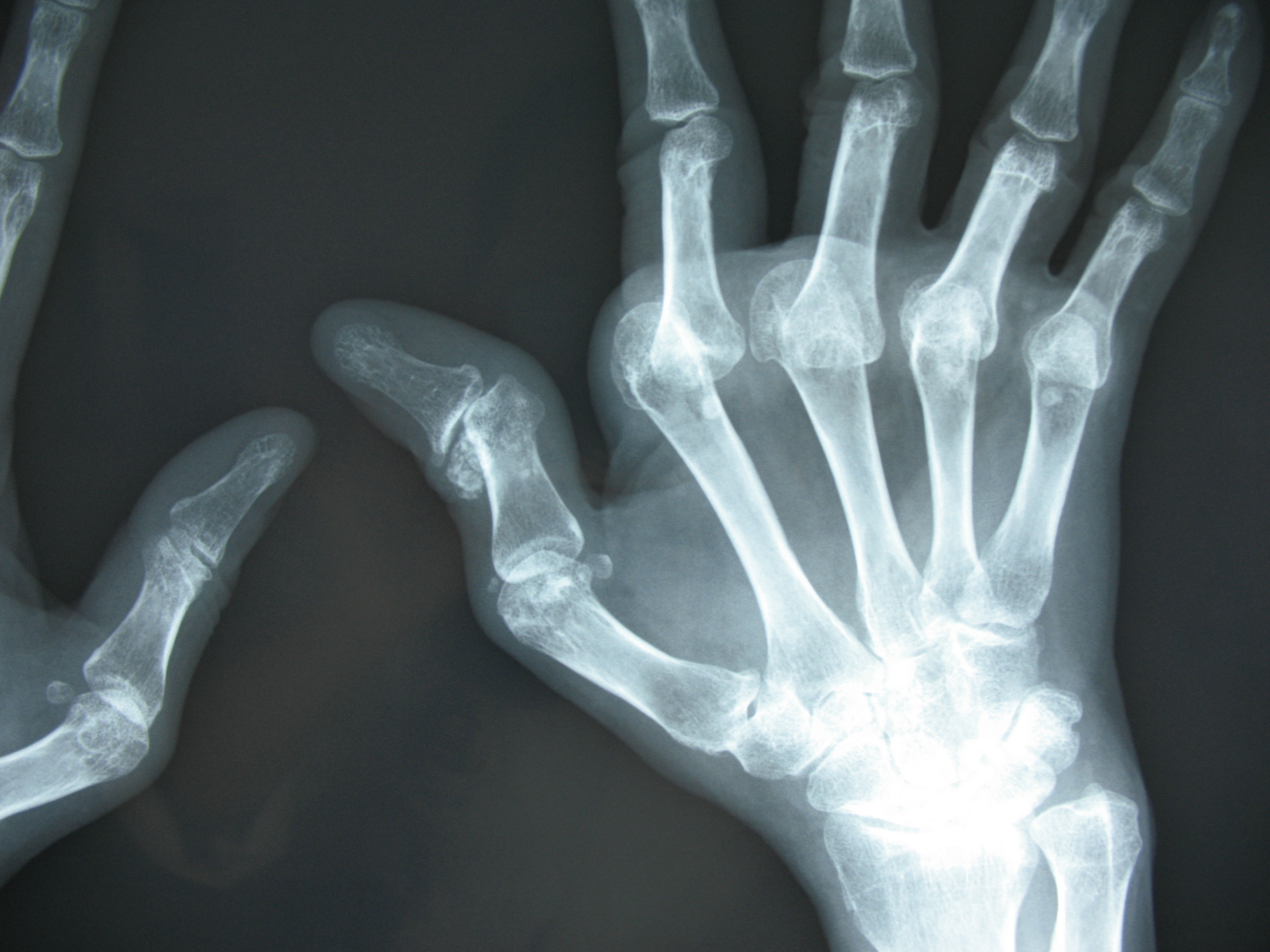case006_02.jpg case006_02.jpg