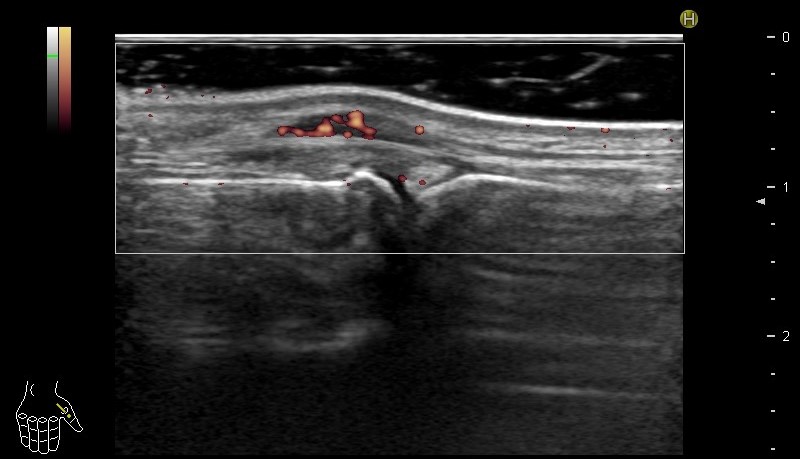 case006_03.jpg case006_03.jpg