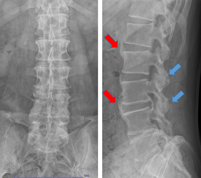 case007_01.png case007_01.png