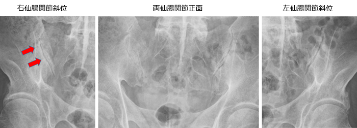 case007_03.png case007_03.png