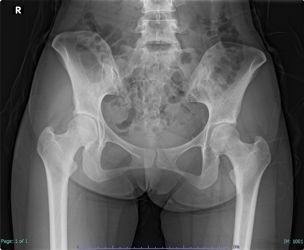 case008_01.png case008_01.png