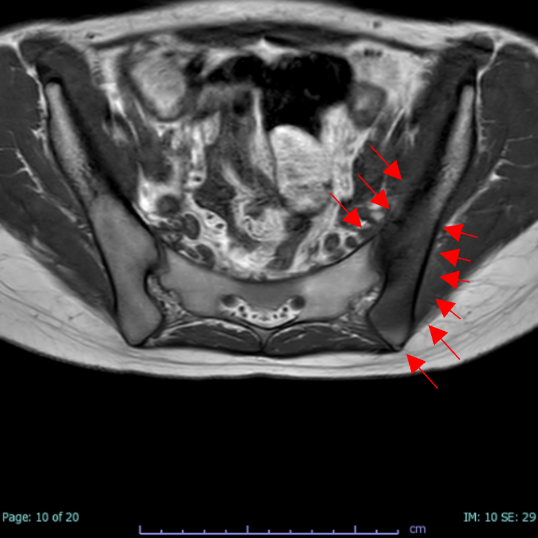case008_02.png case008_02.png