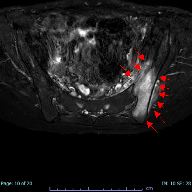 case008_03.png case008_03.png