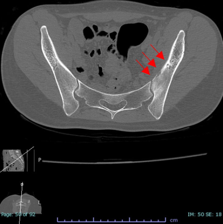 case008_04.png case008_04.png