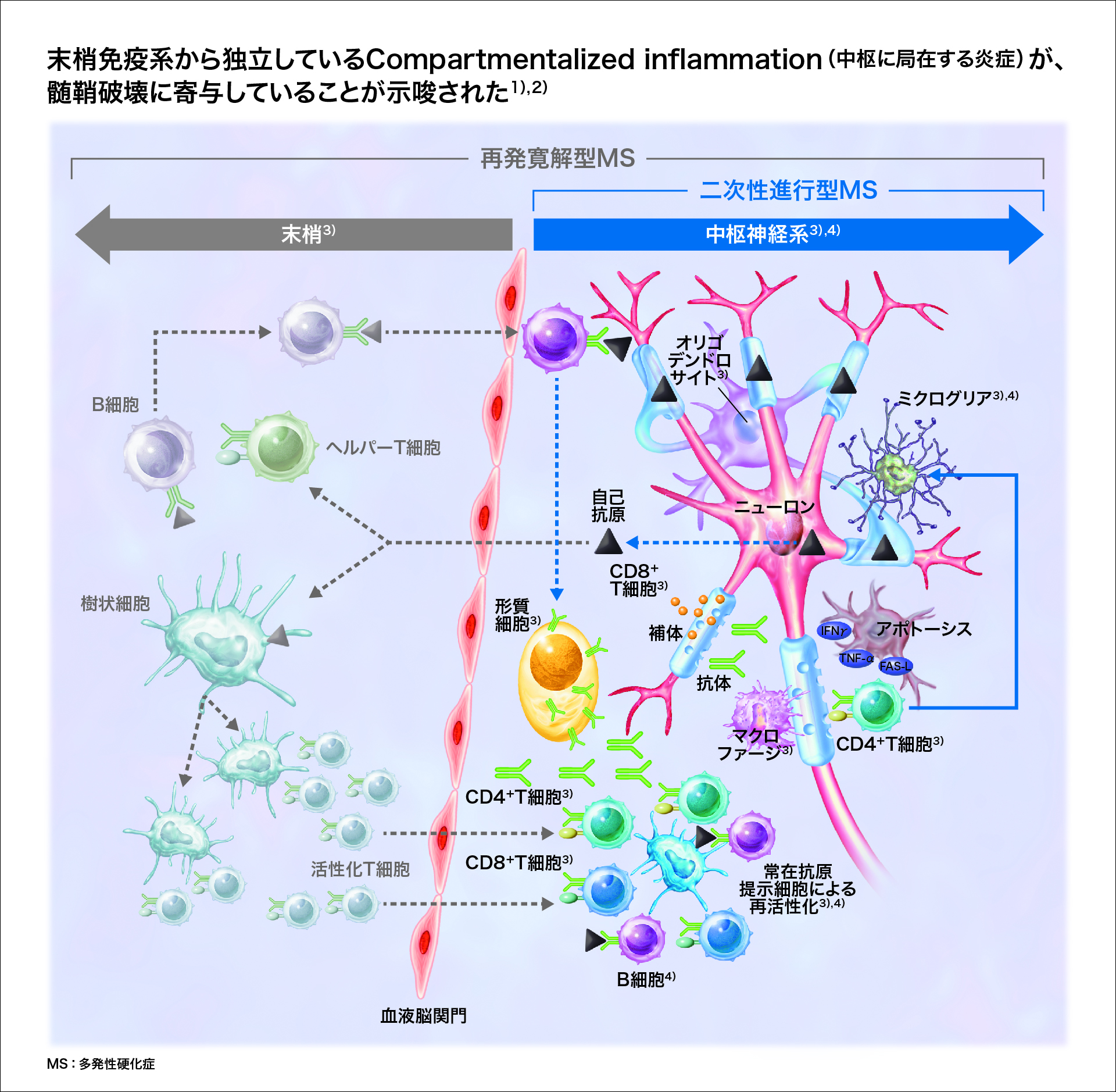 ns_ms_pathology_mod_05.jpg ns_ms_pathology_mod_05.jpg