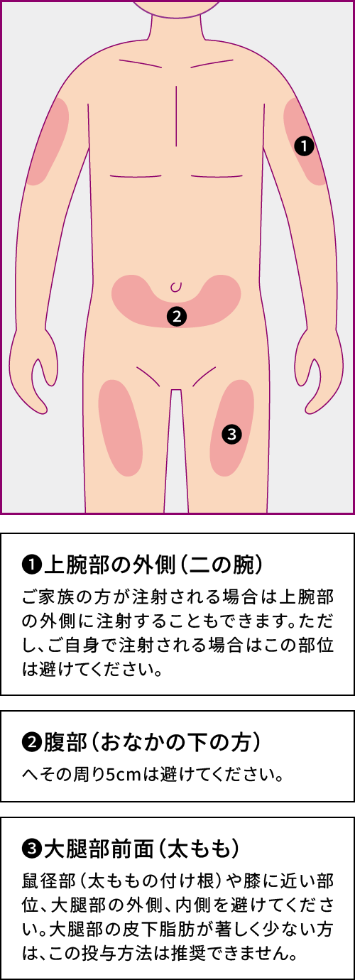 ゾレアの投与部位、皮下注射とは? ゾレアの投与部位、皮下注射とは?