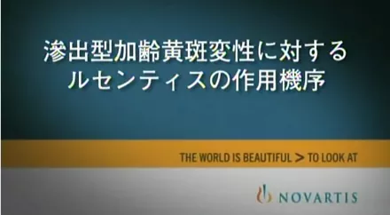 products_lucentis_thumbnail_LUC_movie_01