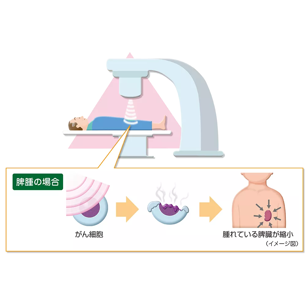drs_net_ic15_04_rev.png drs_net_ic15_04_rev.png